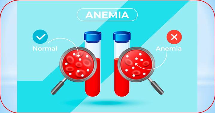 A Complete Guide to Anemia: Causes, Signs, Diagnosis, and Management