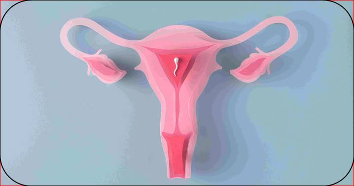 Why PCOS Is More Than a Reproductive Disorder