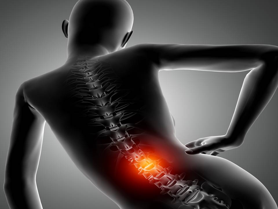 Back Pain